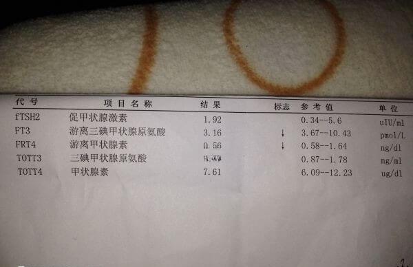 甲减就是甲状腺功能减退