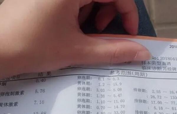 激素六项检查的准确时间不可一概而论