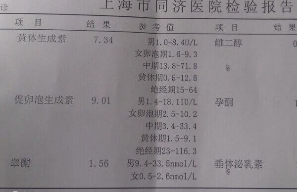 月经第3天检查激素六项很准