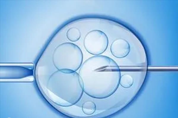 高促性腺激素性无排卵不适合促排卵