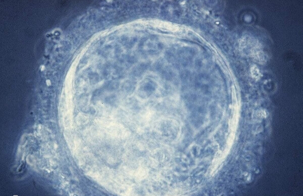 囊胚开头数字不能评断质量好坏