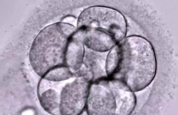 拮抗剂方案移植鲜胚冻胚都可以