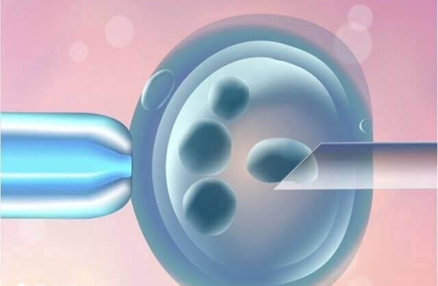 自然周期促排取卵时间都是因人而异