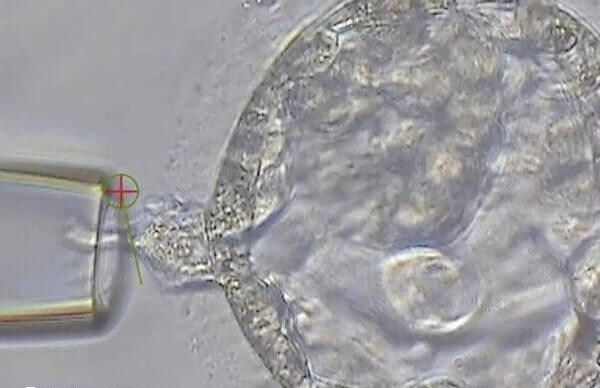 卵泡发育缓慢是降调不成功的症状之一