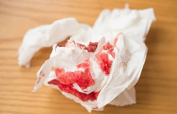 取卵后出鲜红色血可能是激素水平波动所致
