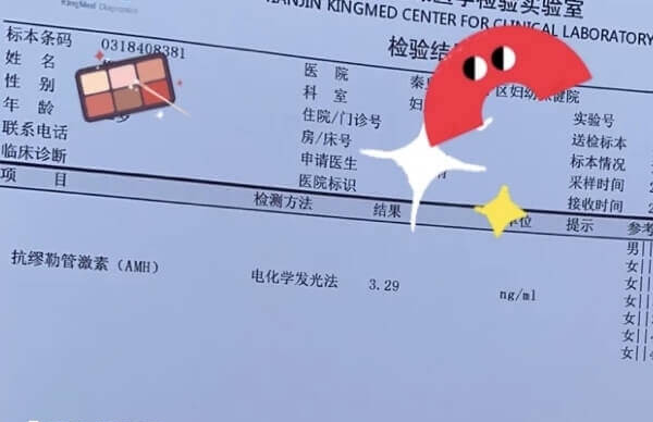 抗缪勒氏管检查单