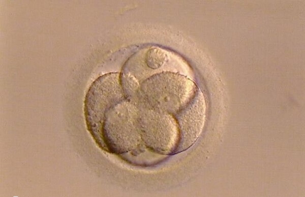 4cc囊胚有必要移植