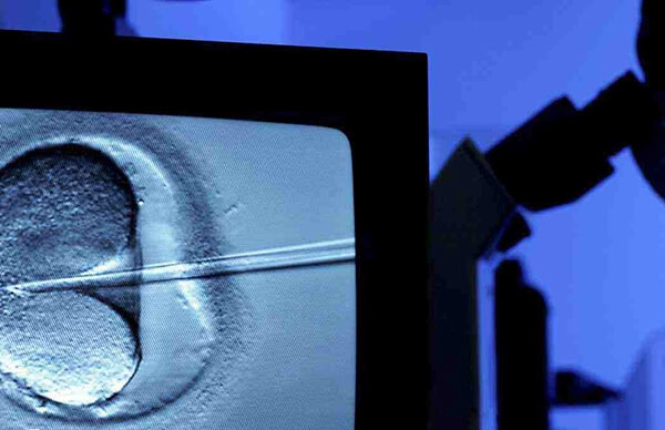 拮抗剂方案能有效降低OHSS风险