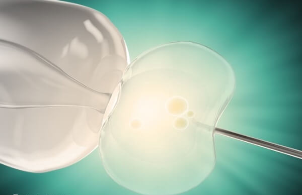 补救ICSI不能保证100%受精成功