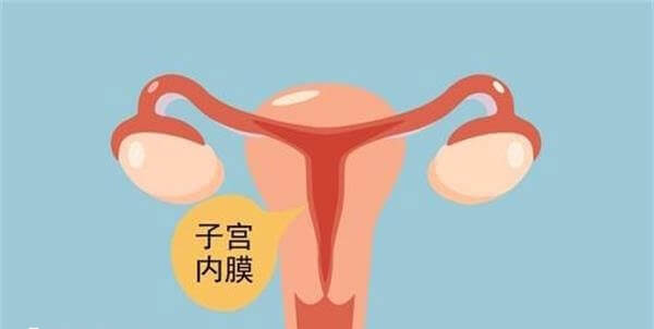 宫腔灌注可以使得子宫内膜增殖
