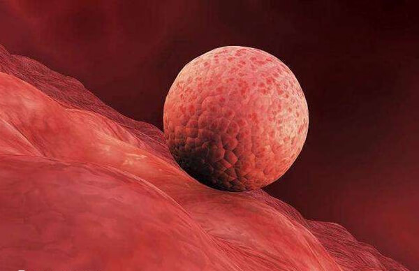 冻胚移植前需要进行内膜准备