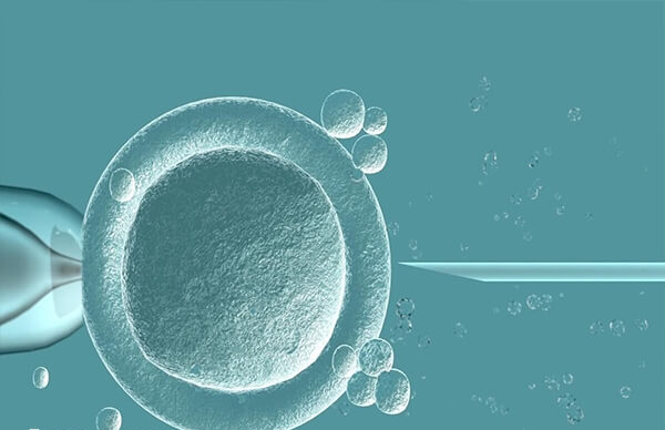 做人工授精女性年龄不宜过大