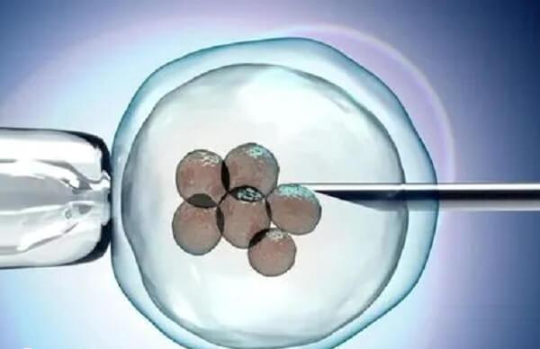 双胎妊娠会显著增加孕期并发症风险