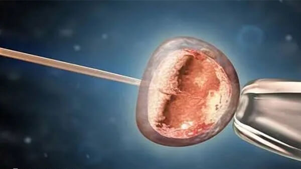 宿迁妇保院试管龙凤胎约3-5万元