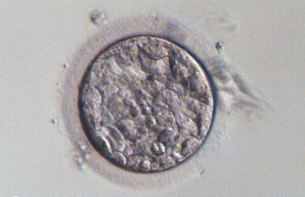 试管婴儿单胎男孩占比53.97%