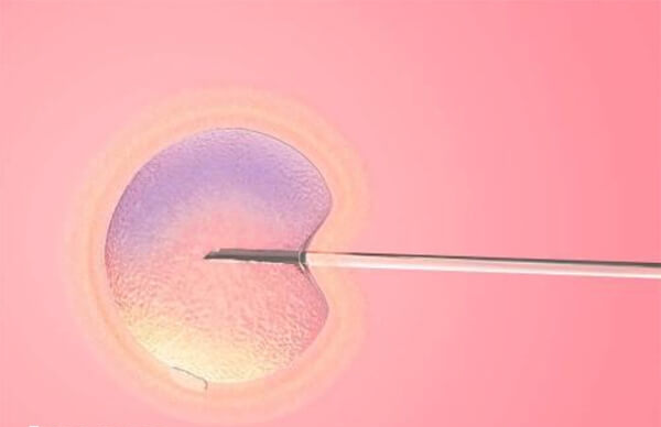 上海集爱医院做试管婴儿成功率高