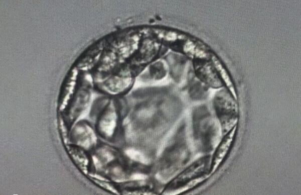 子宫内膜薄容易生化妊娠