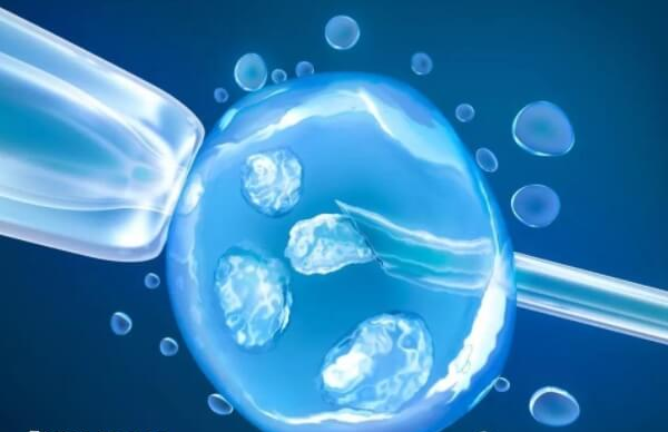 四代试管有优缺点