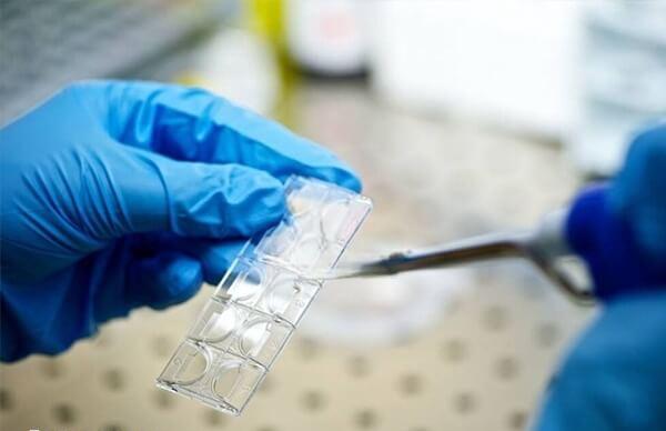 试管婴儿取卵过程并不复杂