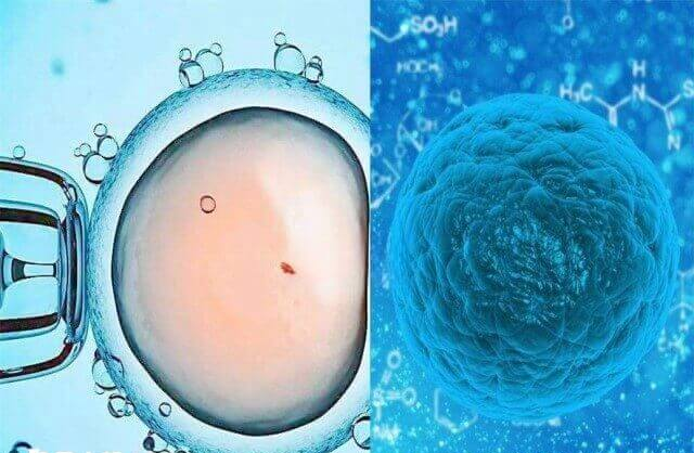 取卵是辅助生殖技术中的一个步骤