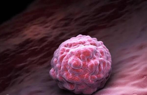 试管移植子宫动脉血流根据妊娠时期的不同