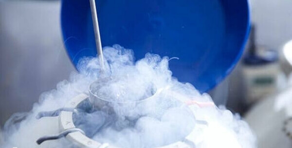 日本冷冻卵子费用