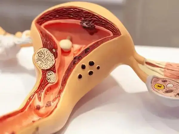 子宫内膜是胚胎着床的关键