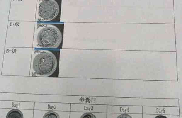 囊胚4bb属于中等级别