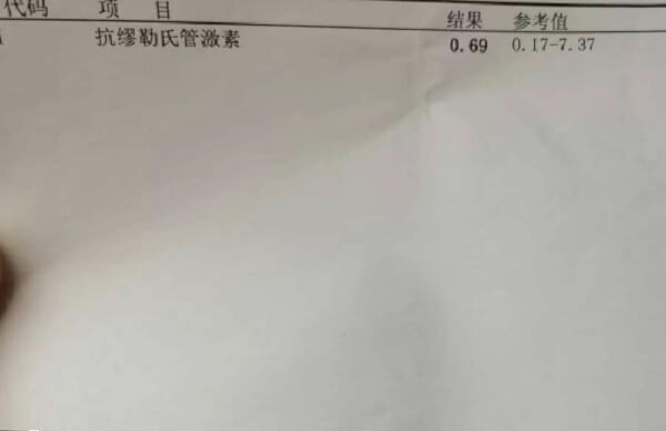 胚胎没过PGS筛查就移植会增加流产风险