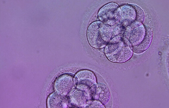 养囊可以提高试管移植成功率