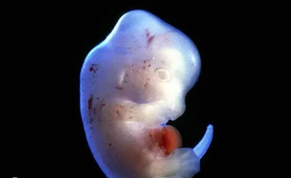 子宫环境差易导致试管婴儿失败