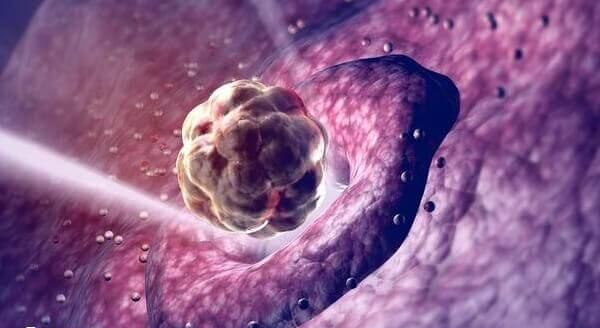 5cb囊胚不是优质胚胎