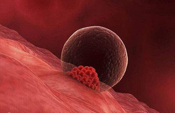 导致卵泡圆形变椭圆的因素较多