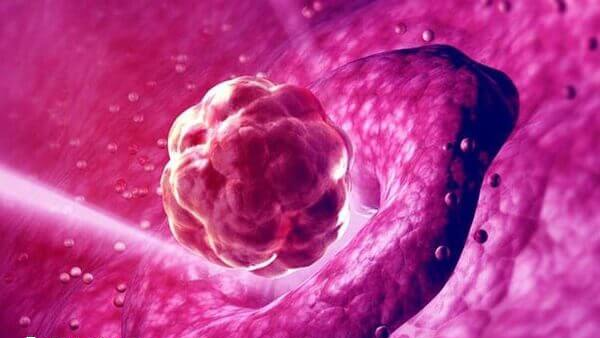 10细胞1级胚胎质量不错