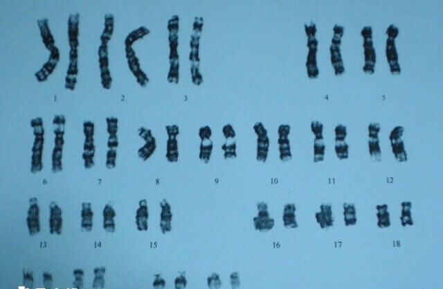 1.5Mb以下且无基因的重复通常属正常范围