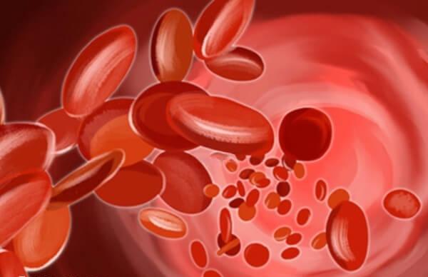 地中海贫血是一种遗传性溶血性贫血