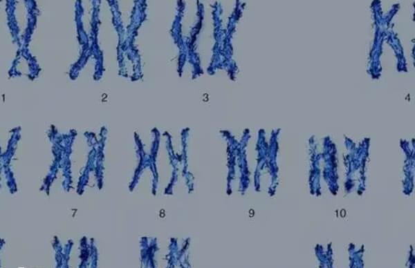 同卵双胞胎的性别由受精时精子的性染色体决定