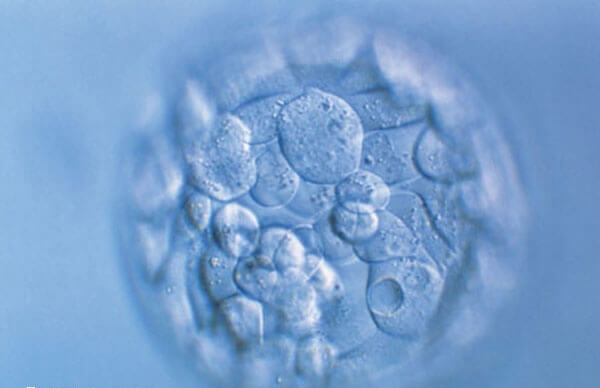 子宫内膜环境是决定卵子质量的因素之一