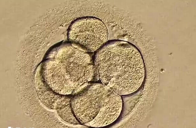 一卵多精可考虑辅助孵化技术改善