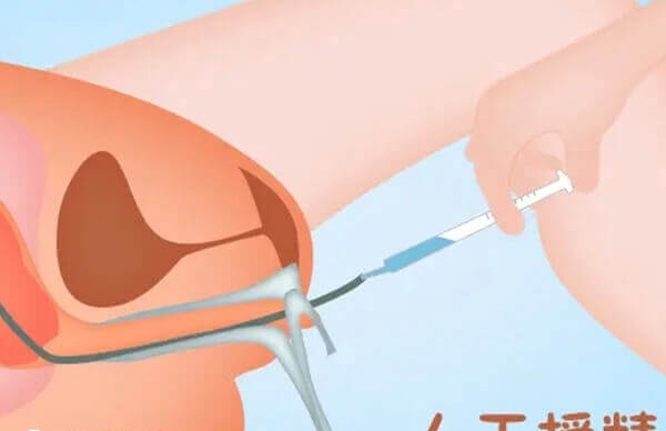 人工授精的操作流程