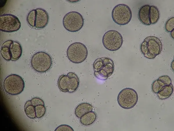 取卵后腹水要注意调理好身体