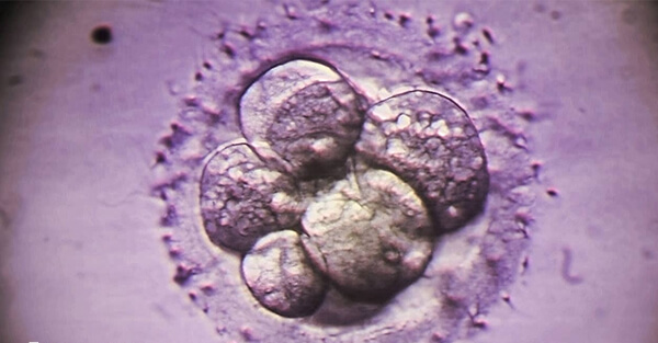 胚胎染色体异常不能正常发育