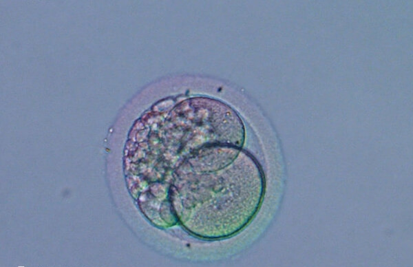 移植胚胎后感染病毒会出现胎停育