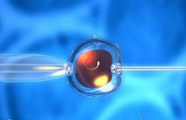 试管婴儿养囊成功可能要冷冻胚胎
