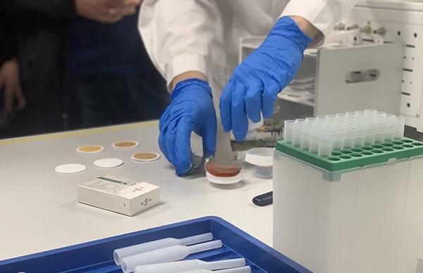 养囊并非对所有患者都必要