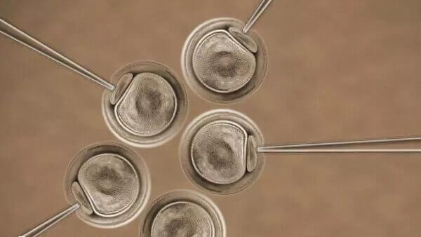 囊胚移植后没感觉是正常的