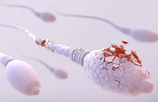 囊肿是引起血精常见因素