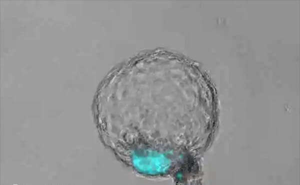 试管婴儿囊胚移植着床率高