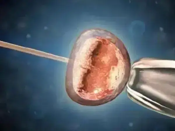 一般少量的腹水自己会慢慢吸收掉