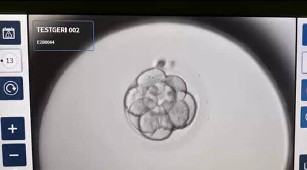 配成C级胚胎的原因可能涉及多个方面